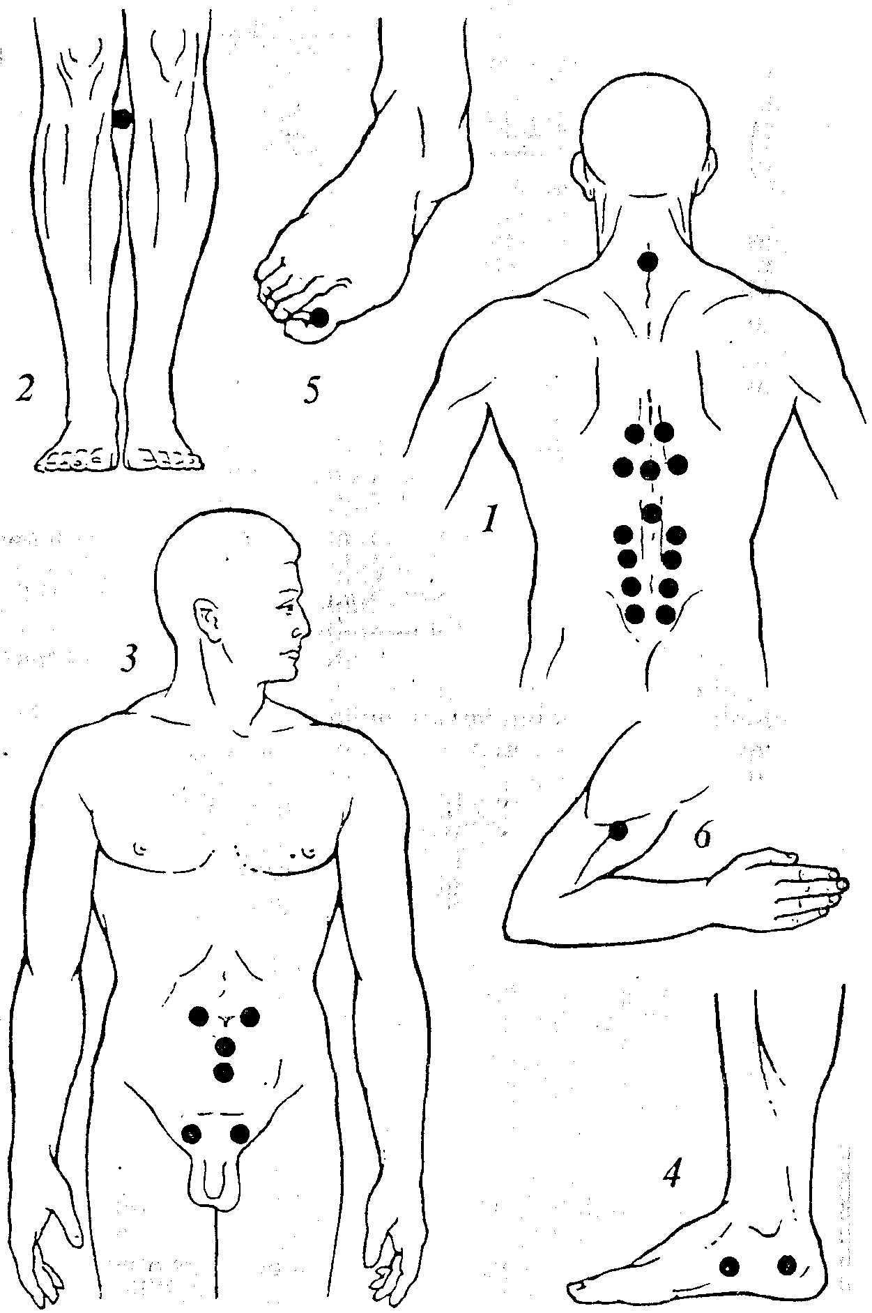 Рисунки показывают точки массажа для каждой болезни. 